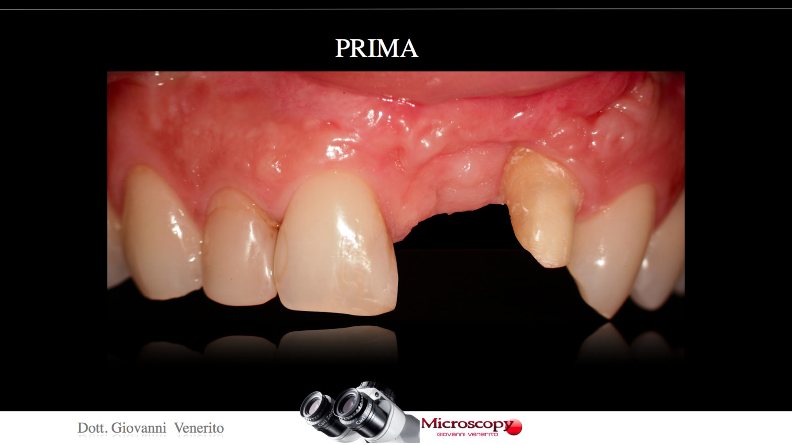 diapositiva.054